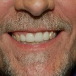 Close-up of smiling man's mouth showing healthy white teeth and gums