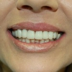 Close-up of a person's smile showing bright, white teeth and healthy gums.