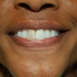 Person smiling brightly, displaying white teeth and healthy smile for dental practice