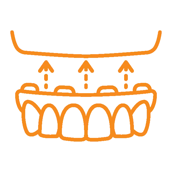 Orange dental implants icon showing teeth with arrows indicating upward placement or restoration process.