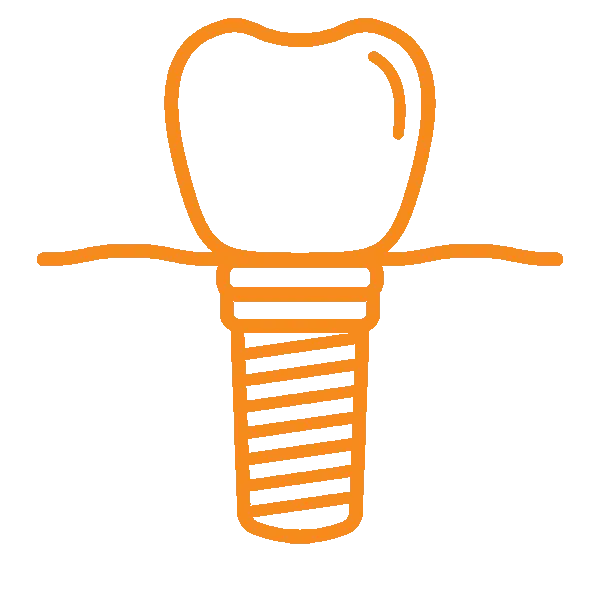 Dental implant illustration showing artificial tooth crown and root structure in orange line art.