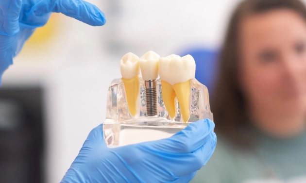 Dentist in blue gloves holds dental implant model showing tooth restoration components in clinical setting.
